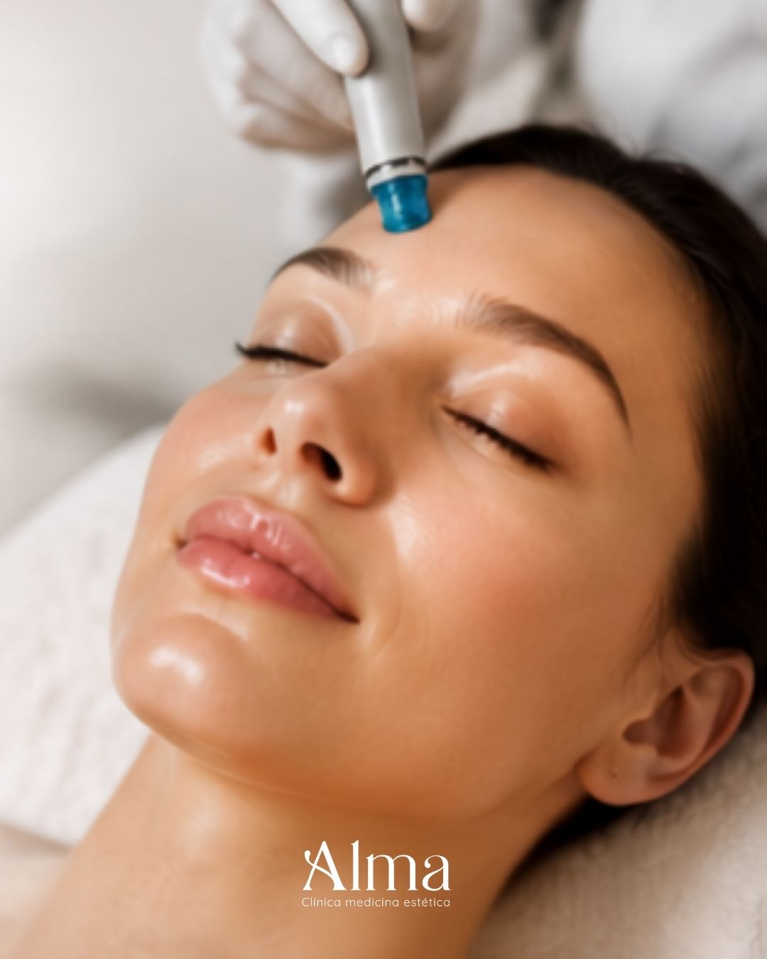 Pack Hidrafacial: 3 sesiones