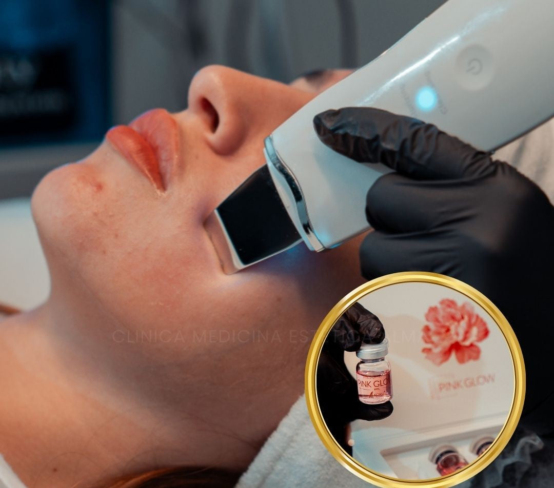 Hidrafacial + Mesoterapia Pink glow