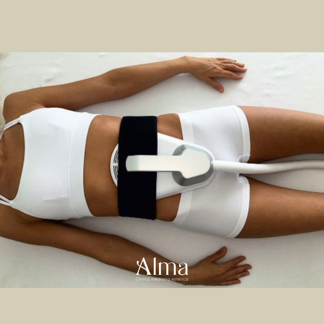 Tonificación muscular 8 sesiones 1 zona