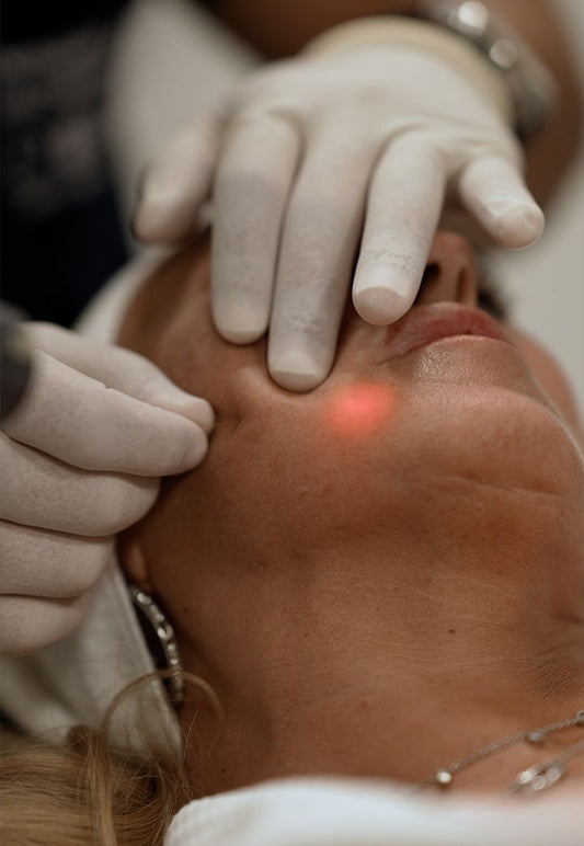 Endolifting facial
