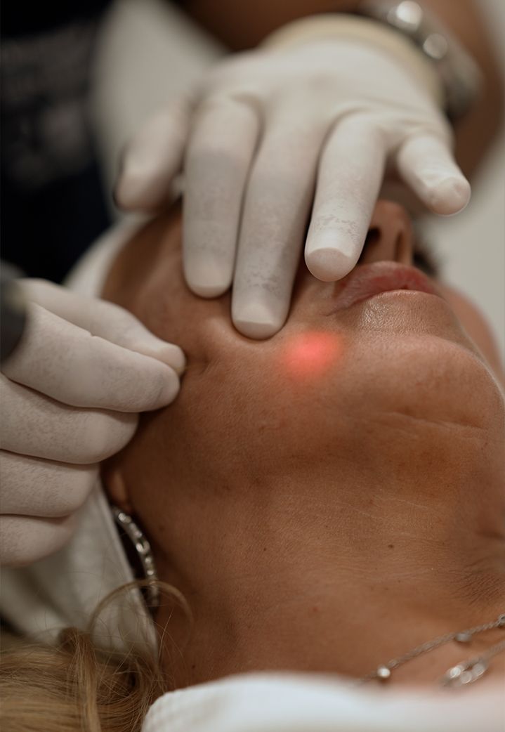 Endolifting facial