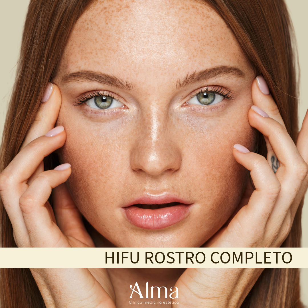 HIFU rostro completo (1 Sesión)