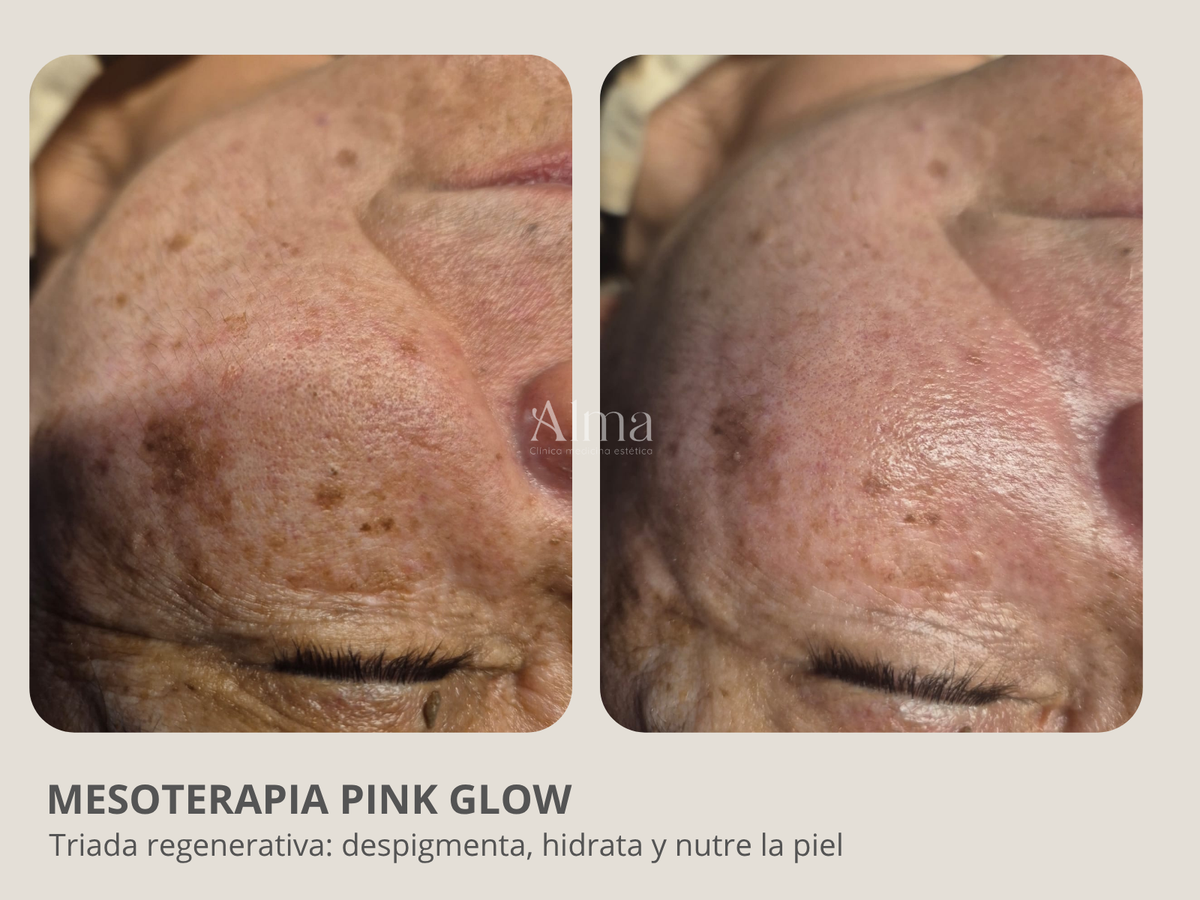 Plan anual medicina estética
