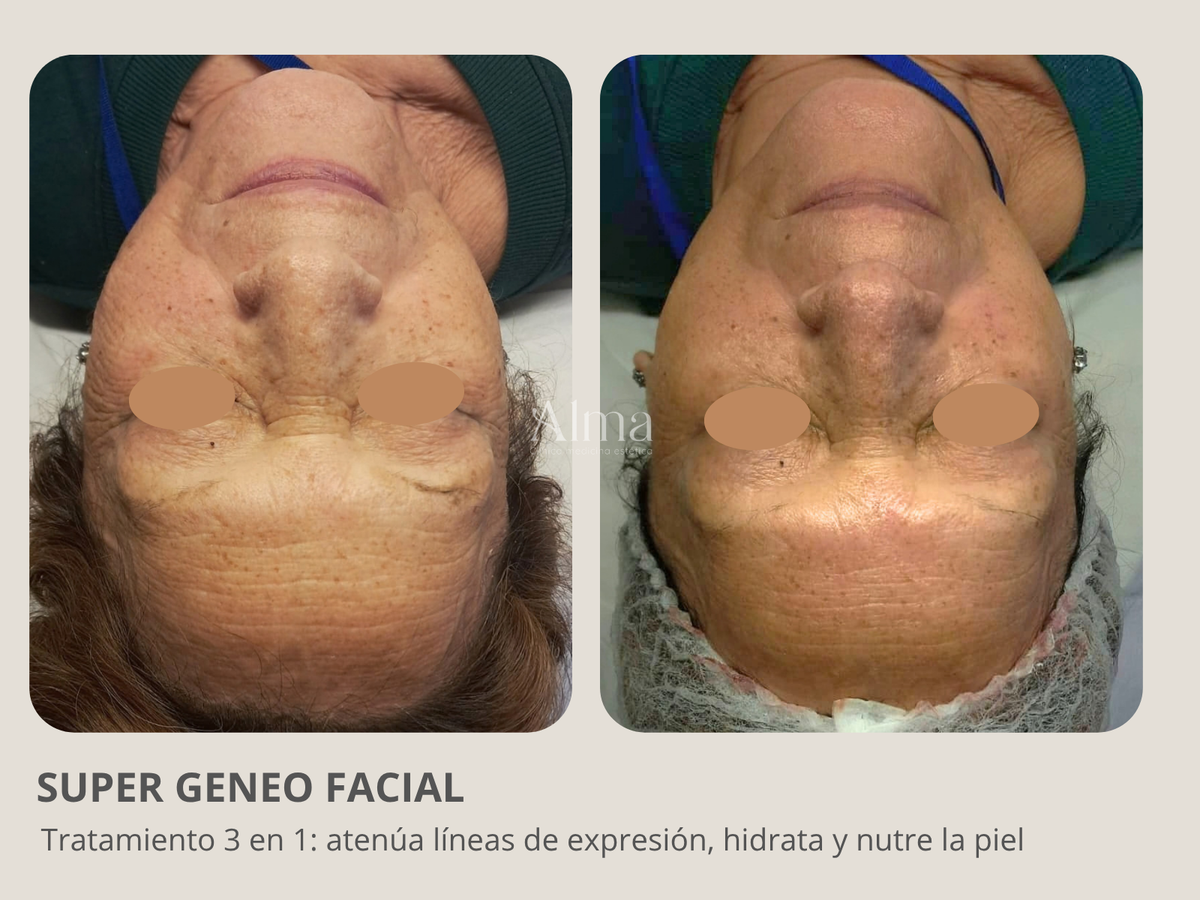 Super Facial Geneo: 3 en 1