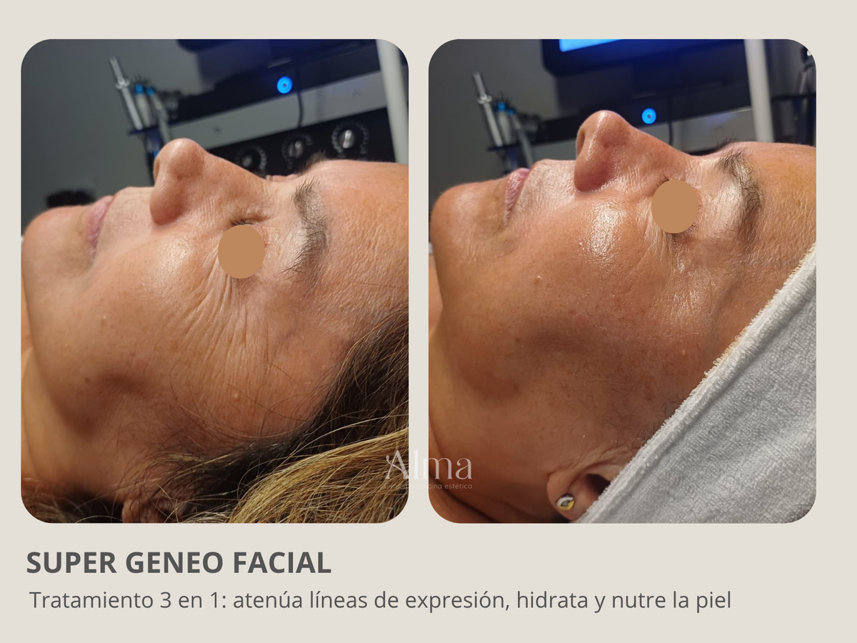 Super Facial Geneo: 3 en 1