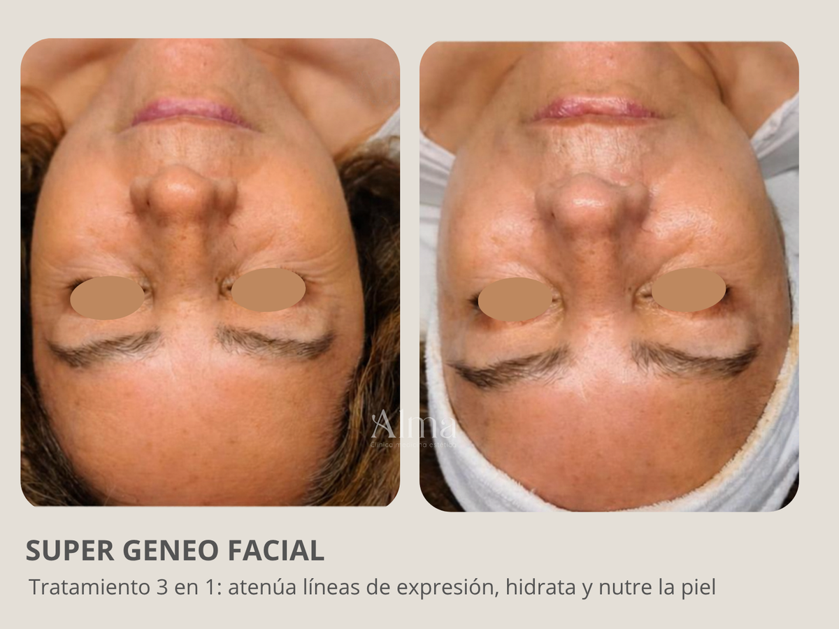 Super Facial Geneo: 3 en 1