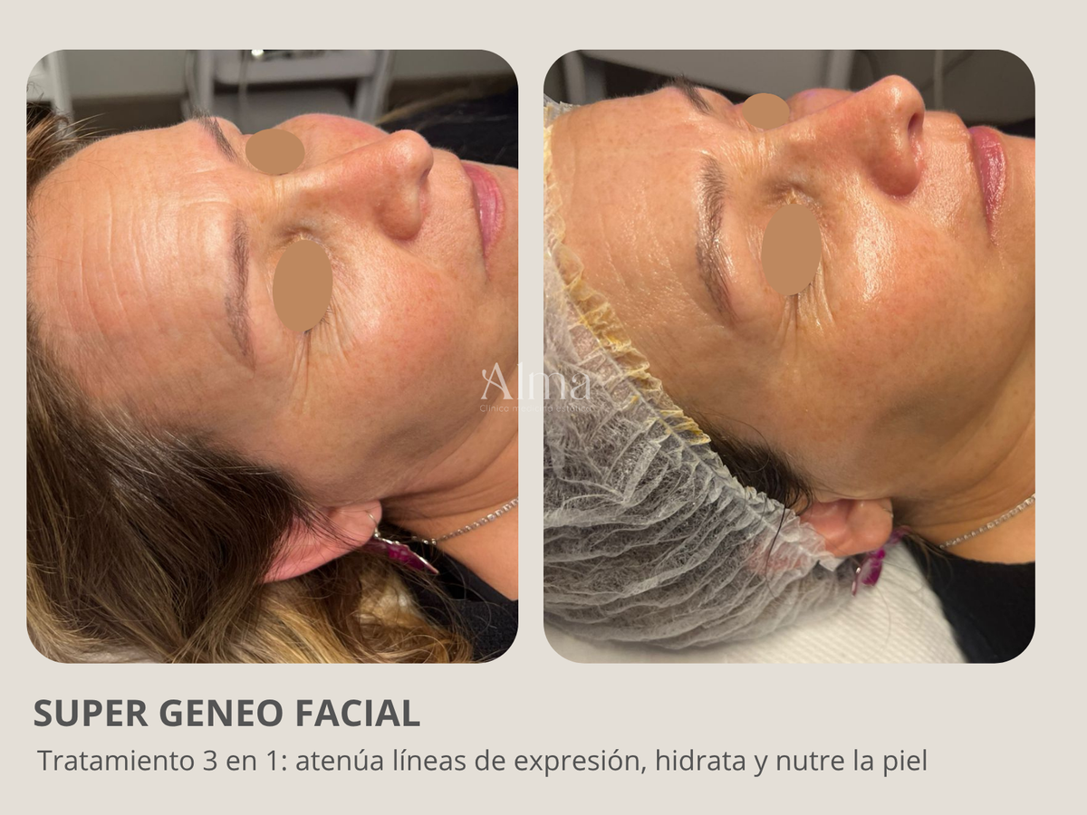 Super Facial Geneo: 3 en 1