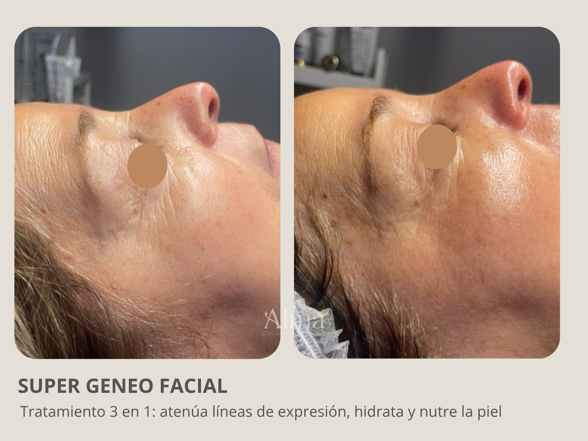 Super Facial Geneo: 3 en 1