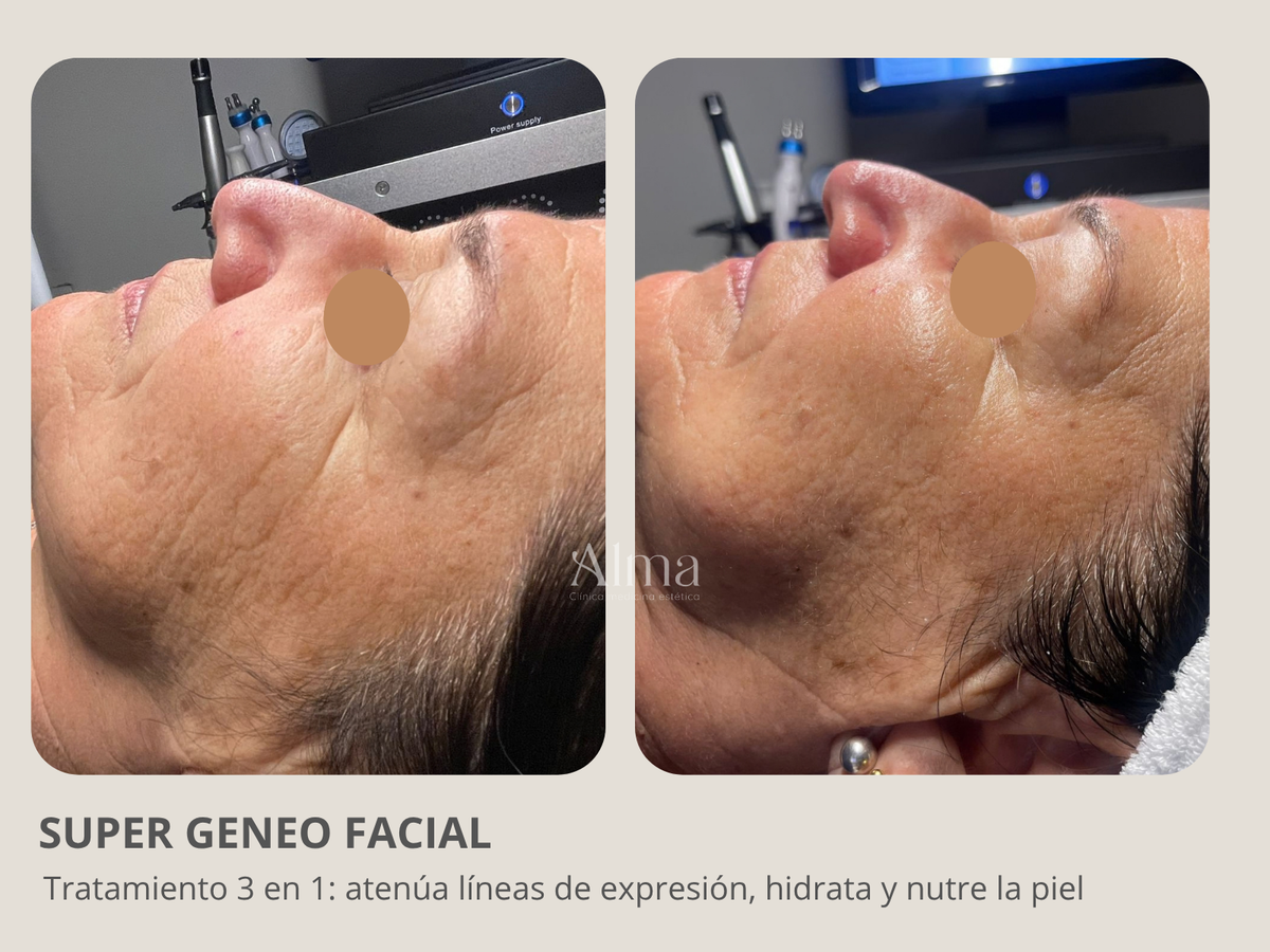 Super Facial Geneo: 3 en 1