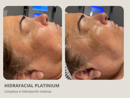 Plan Hidrafacial: 3 sesiones